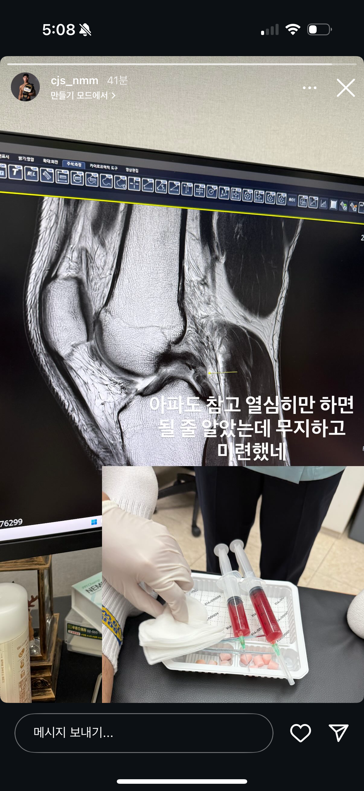 업로드된 이미지